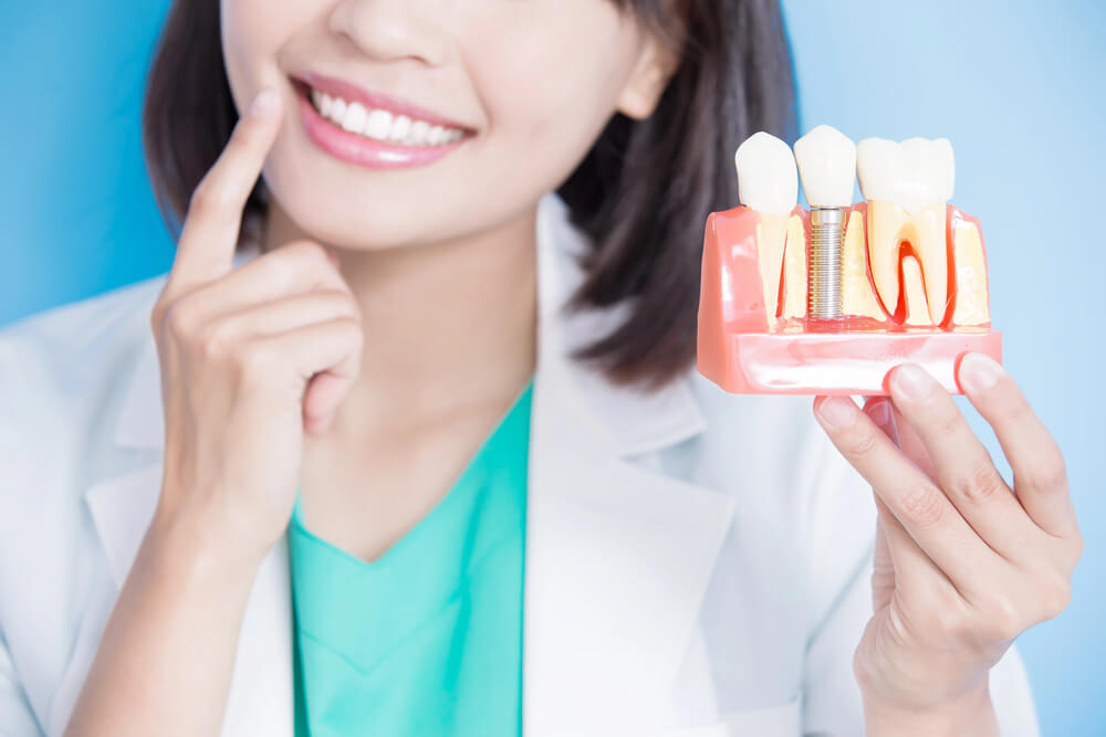 Dental Implant for Missing Teeth